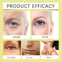 Anti-aging Cream