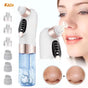 Blackhead Remover Vacuum